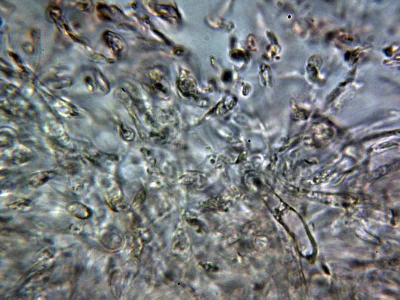 Boletus edulis 12 - Cutícula